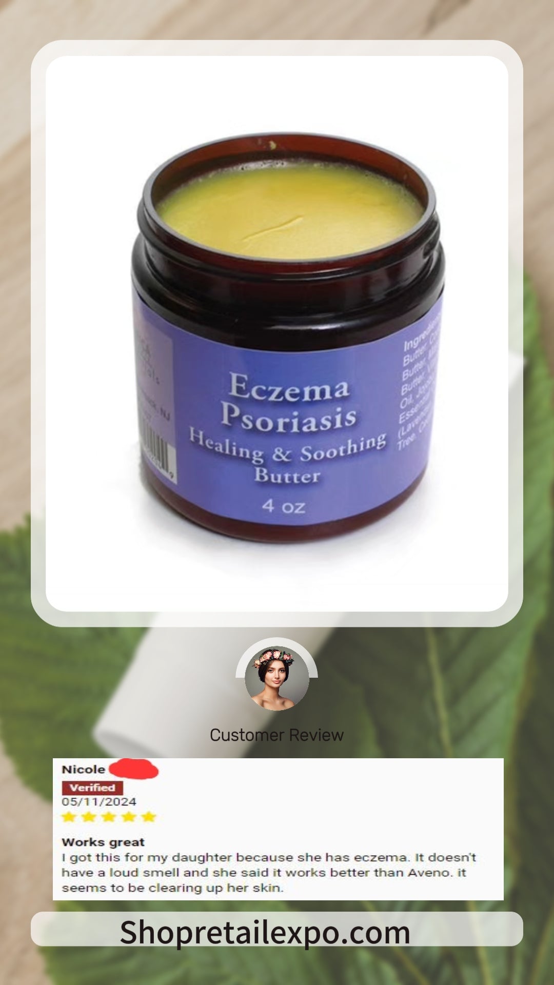 Eczema/Psoriasis Butter